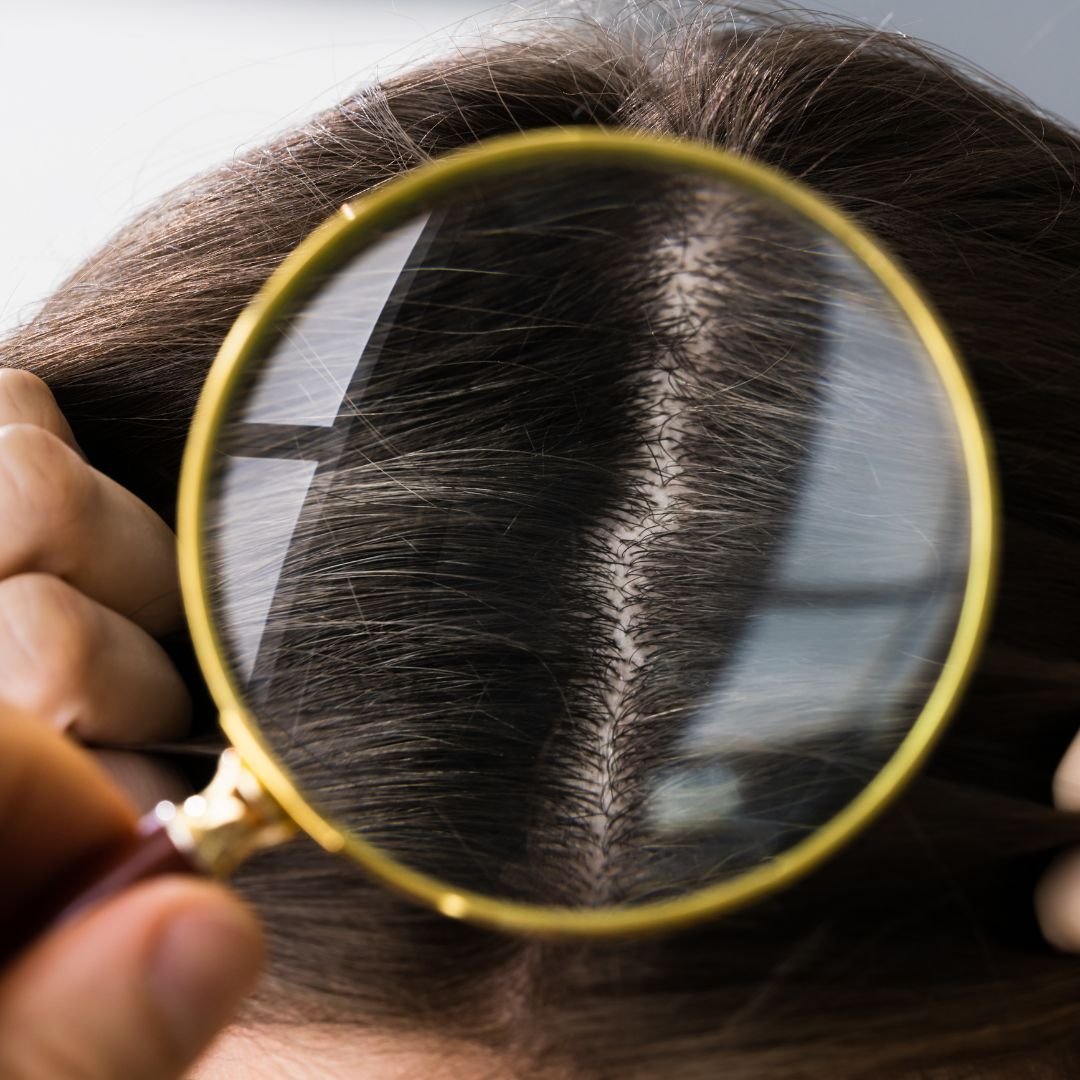 hairfall Reduction